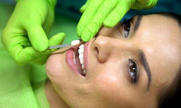 dentist placing veneers in Attleboro on woman