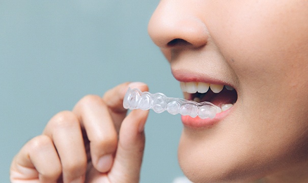 Woman placing a ClearCorrect aligner in her mouth