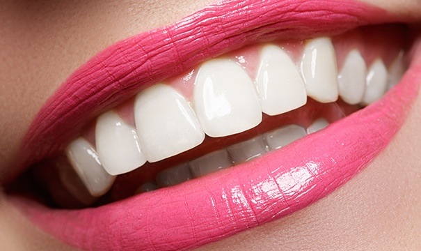Beautiful smile with all ceramic dental restoration