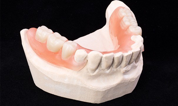 partial denture attleboro