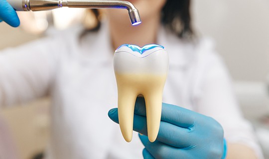 Dentist demonstrating filling in large model tooth
