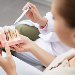 a patient learning how dental implants work