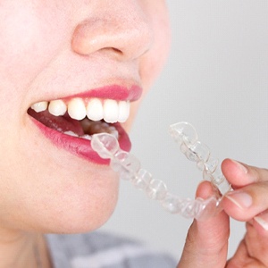 Woman removing her Invisalign in Attleboro aligner