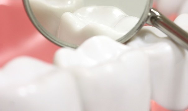 Closeup of smile with dental sealants