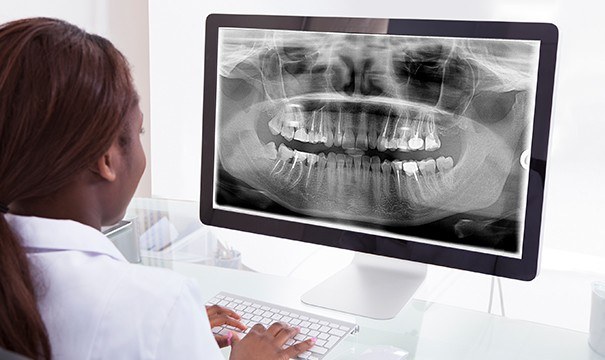 Dentist looking at digital x-rays on computer screen