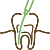 Icon of a dental instrument cleaning the inside of a tooth root