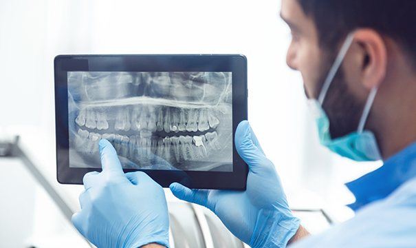 Dentist looking at digital X-rays