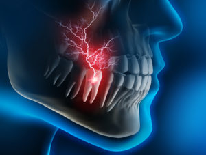 Severe tooth pain