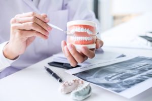 Attleboro dentist holds model of dental implants 
