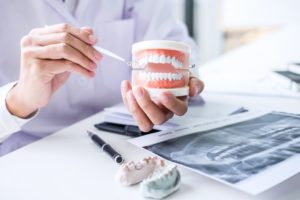 Attleboro dentist holds model of dental implants