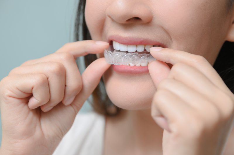 girl putting on Invisalign clear aligners